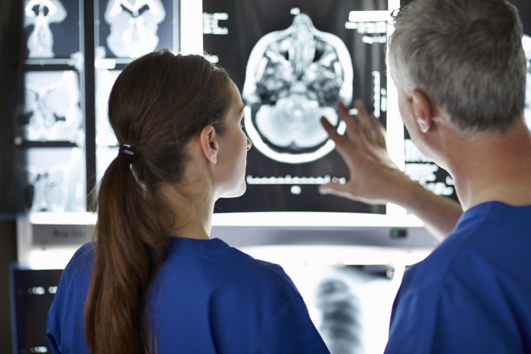 Inteligência Artificial agiliza diagnóstico de AVC